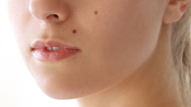 Ý nghĩa nốt ruồi trên mặt nam, nữ từng vị trí theo nhân tướng học và khoa học